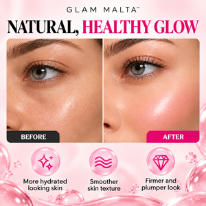 Glam Malta™ PDRN Pink Collagen Multi Balm - Buy 1 Get 1 Free